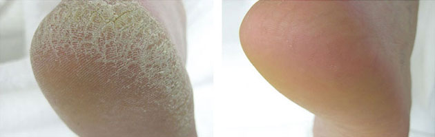 Rough Skin Formula Manicures Pedicures